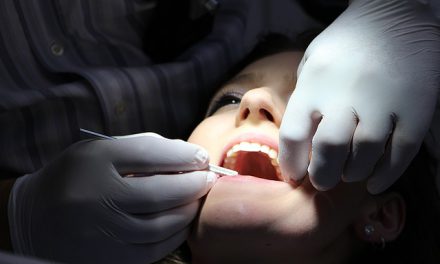 Tanden laten reinigen door de mondhygiënist